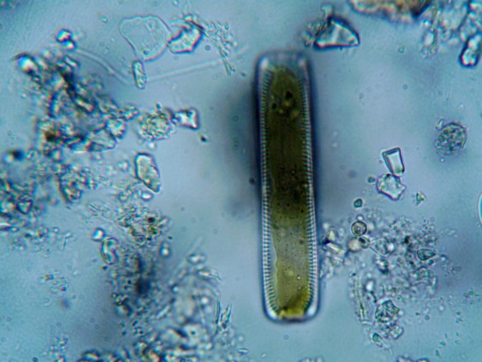 A microscopic view of a plankton.